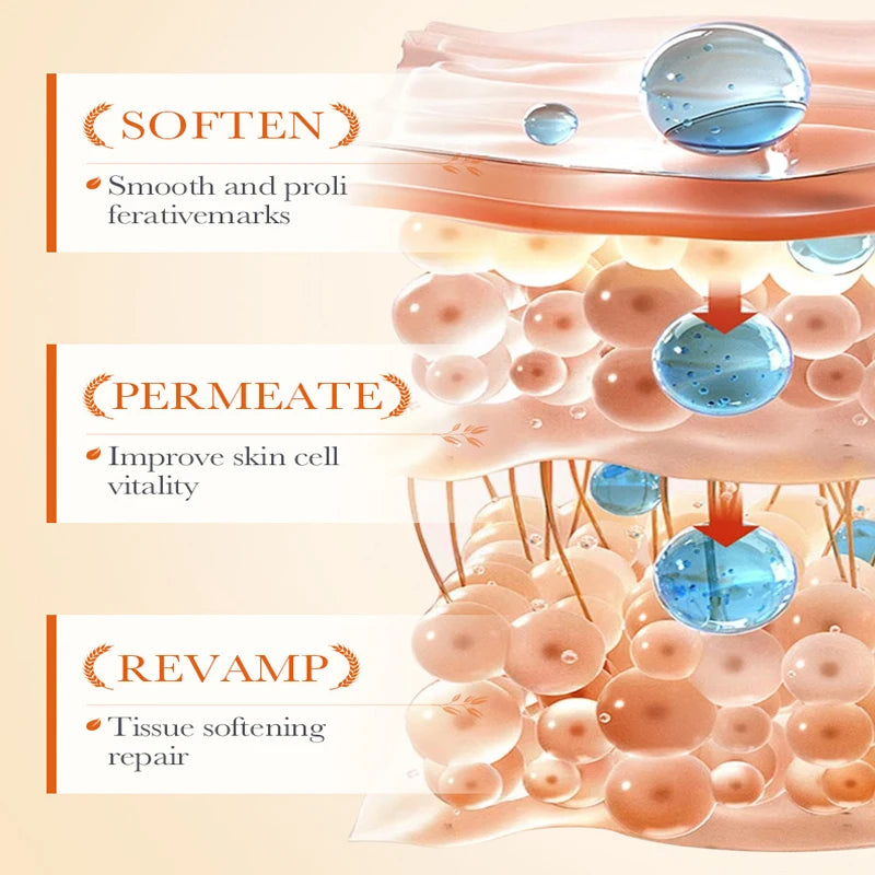 Creme para remoção permanente de estrias